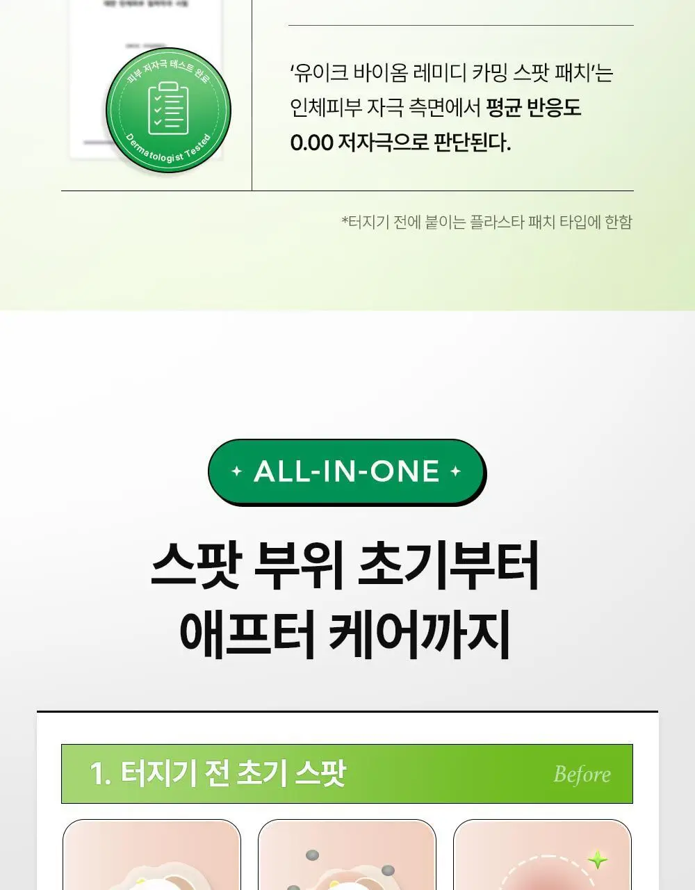 [라이즈 PICK] 유이크 바이옴 레미디 카밍 스팟 패치 2종 택 1 (단품/기획) 상세페이지 23